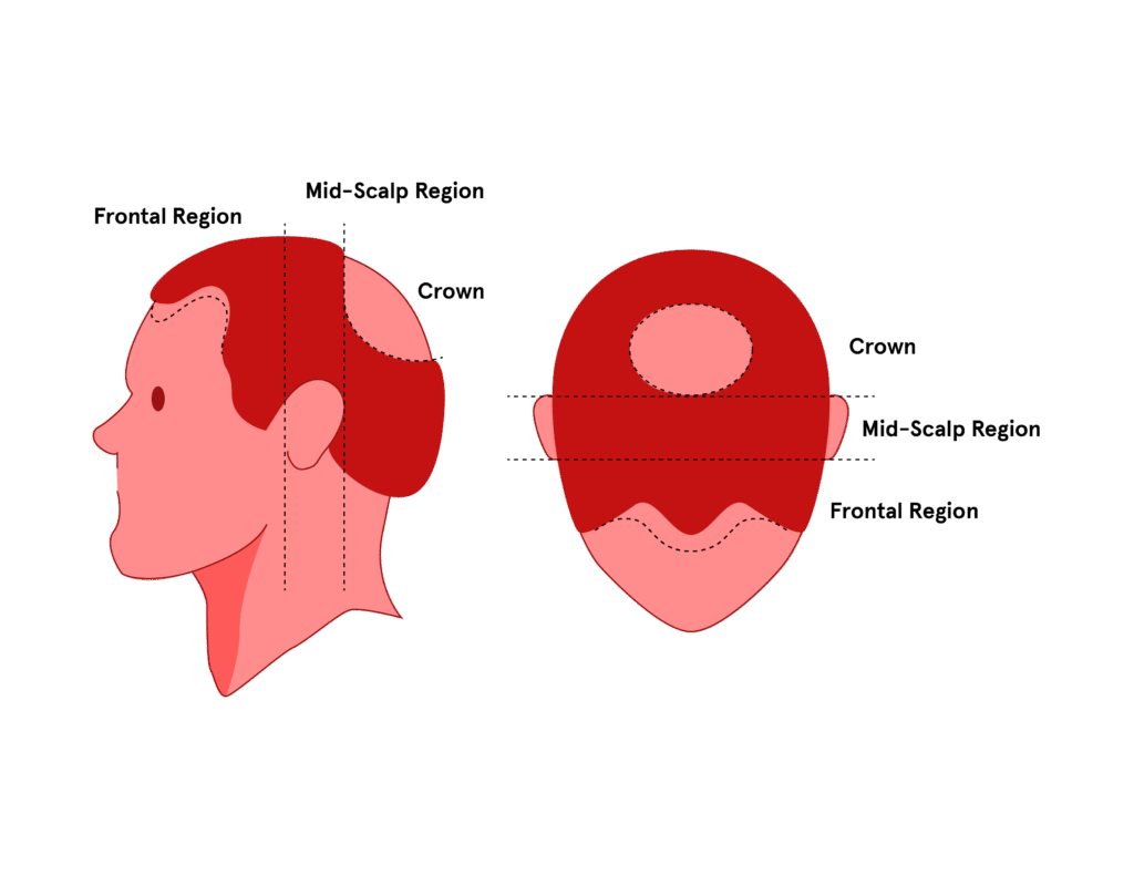 Head Parts Name